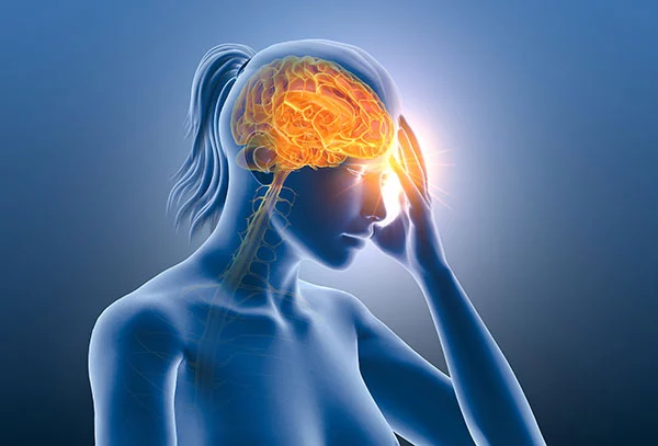 Illustration of woman with a migraine headache